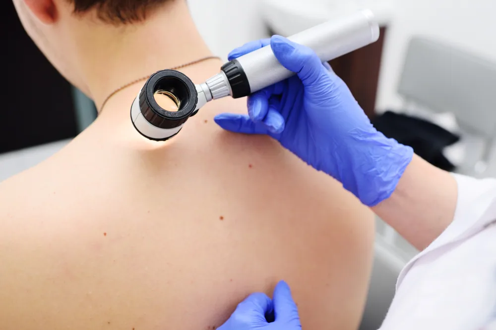 Illustration: What Happens During a Mole Evaluation