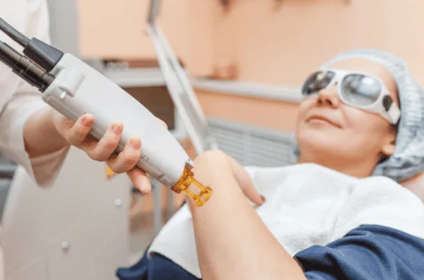 Laser treatment on a patient's hand